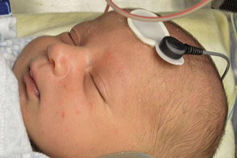 This photo was provided by the University of Miami and Harvard University autism research team. It is an up close image of an infant's face as they are having their hearing tested. 